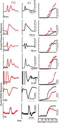 Non-invasive Neuromodulation of Spinal Cord Restores Lower Urinary Tract Function After Paralysis